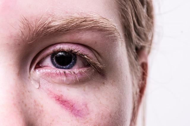 Kam v Hodoníně zanést zraněného ptáka: Kontakty a rady